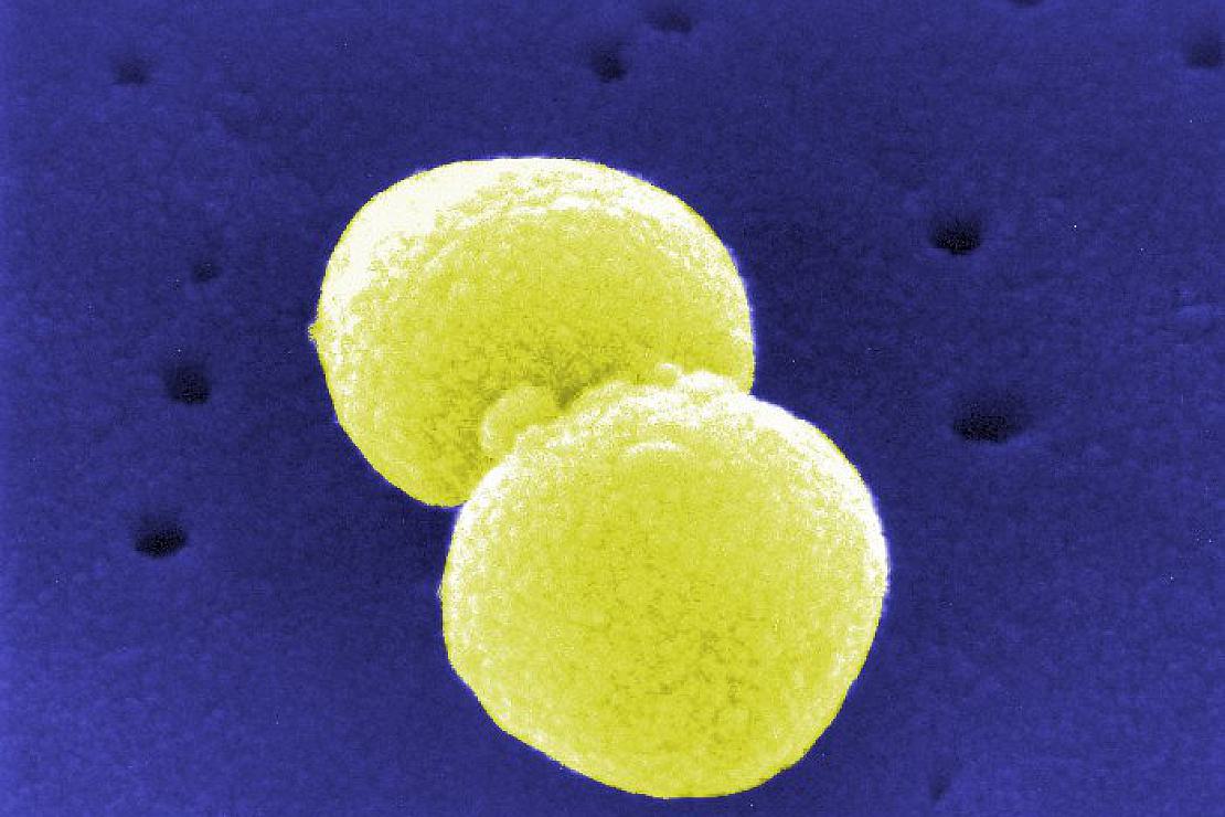 Streptococcus pneumoniae (Archiv)